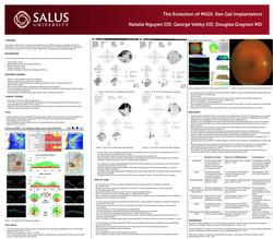 The Evolution of MIGS- Xen Gel Implantation